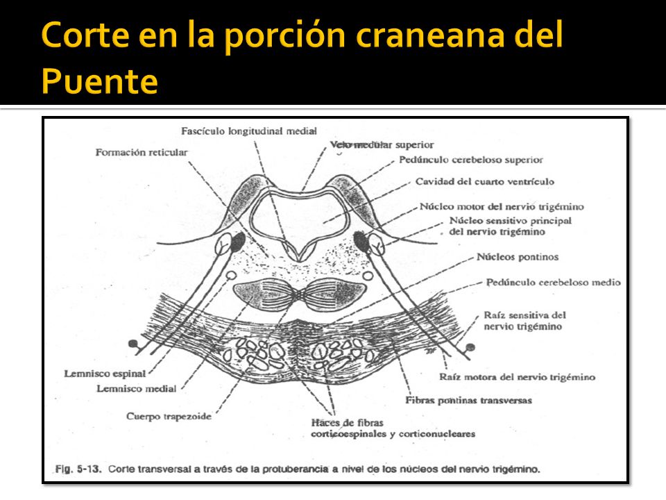 Corte en la porción craneana del Puente