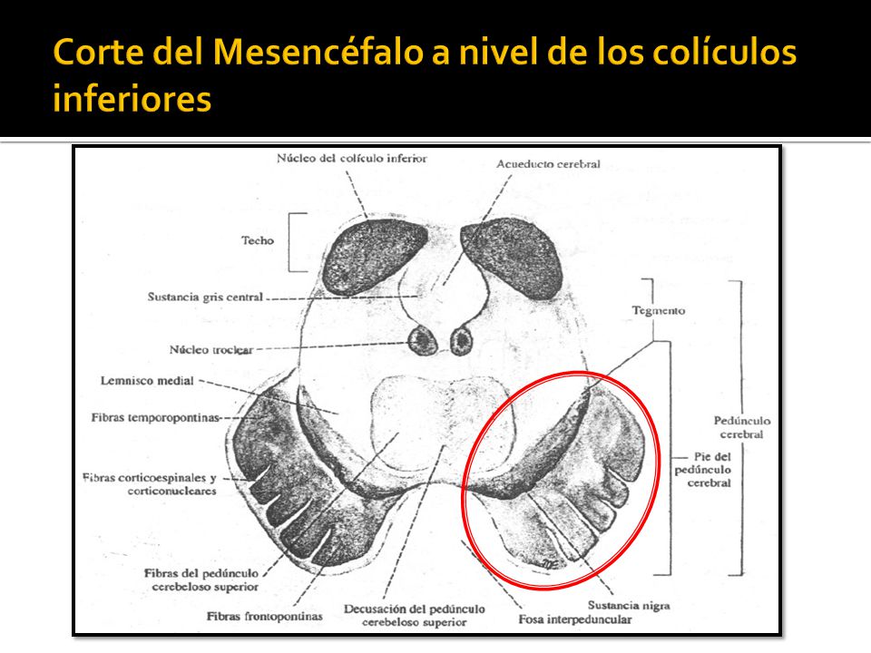 Corte del Mesencéfalo a nivel de los colículos inferiores
