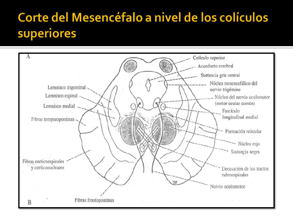 Corte del Mesencéfalo a nivel de los colículos superiores
