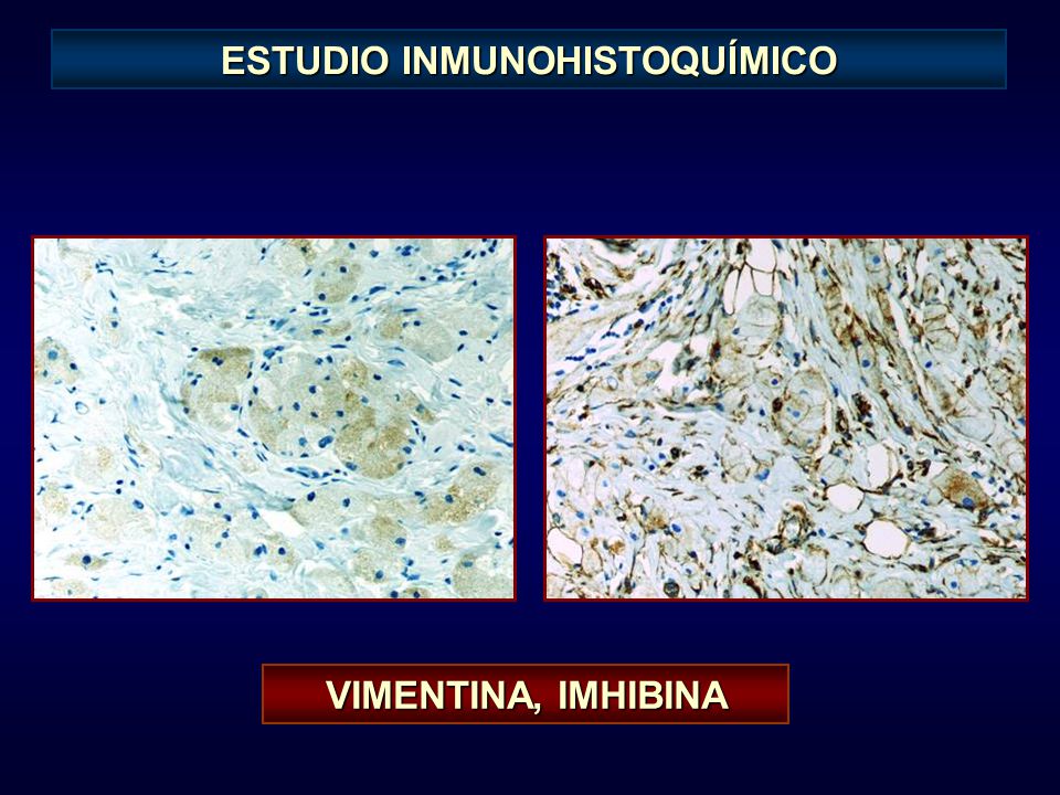 ESTUDIO INMUNOHISTOQUÍMICO