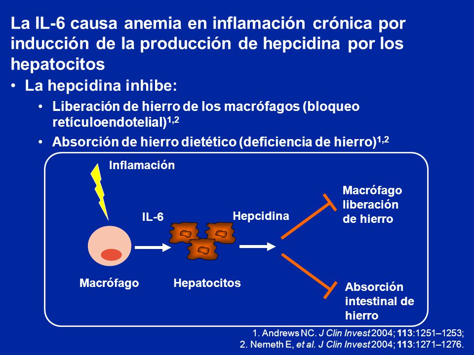 La IL-6 causa anemia en inflamación crónica por inducción de la producción de hepcidina por los hepatocitos