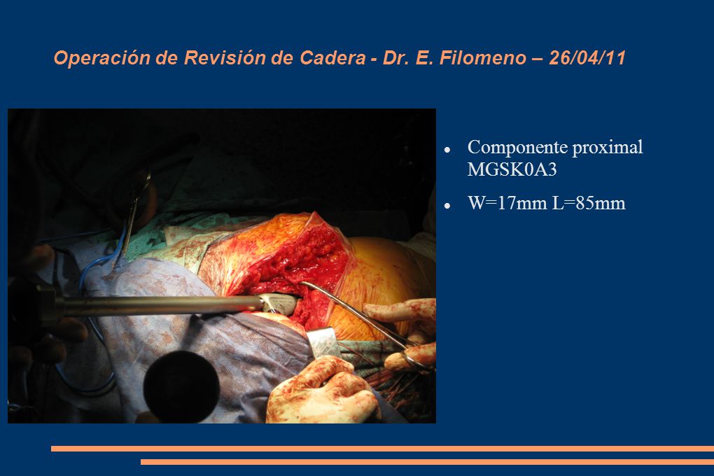Operación de Revisión de Cadera - Dr. E. Filomeno – 26/04/11