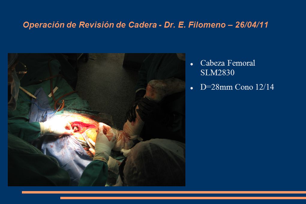 Operación de Revisión de Cadera - Dr. E. Filomeno – 26/04/11