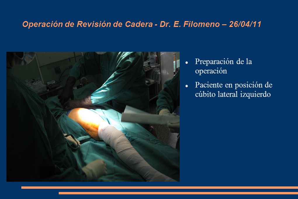 Operación de Revisión de Cadera - Dr. E. Filomeno – 26/04/11