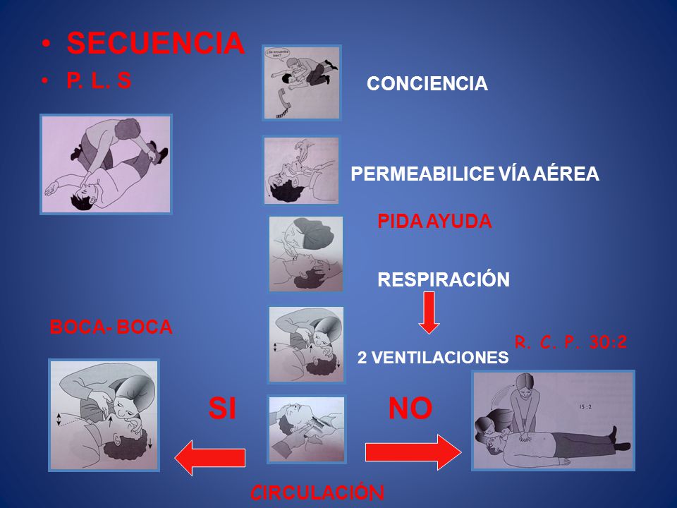 SECUENCIA SI NO P. L. S CONCIENCIA PERMEABILICE VÍA AÉREA PIDA AYUDA