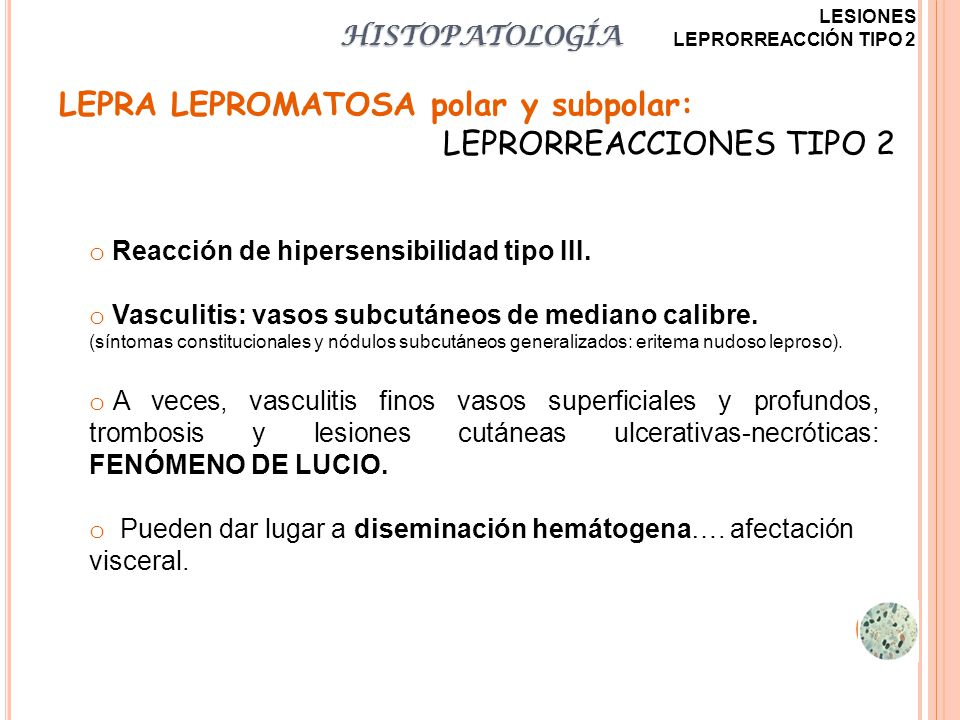 LEPRA LEPROMATOSA polar y subpolar: LEPRORREACCIONES TIPO 2