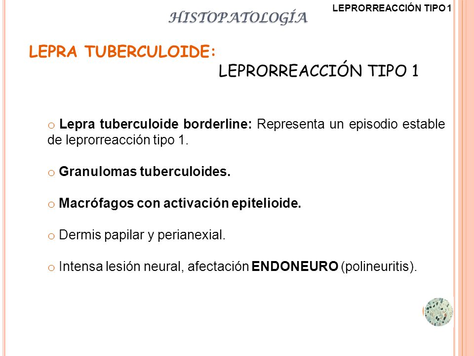 LEPRA TUBERCULOIDE: LEPRORREACCIÓN TIPO 1 HISTOPATOLOGÍA