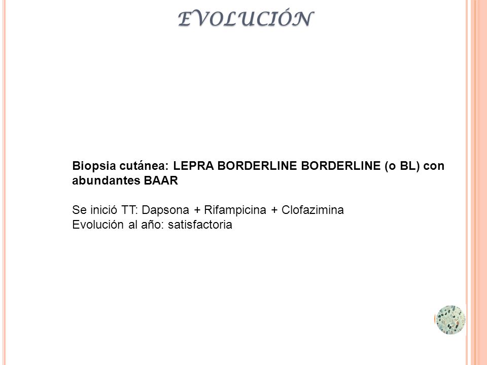 evolución Biopsia cutánea: LEPRA BORDERLINE BORDERLINE (o BL) con abundantes BAAR. Se inició TT: Dapsona + Rifampicina + Clofazimina.