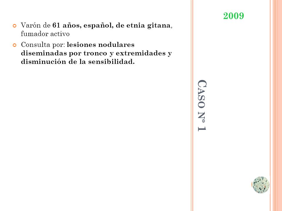 Varón de 61 años, español, de etnia gitana, fumador activo