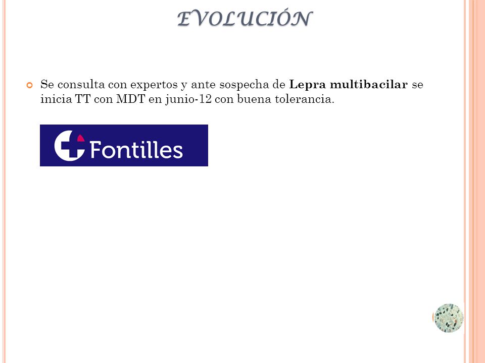 evolución Se consulta con expertos y ante sospecha de Lepra multibacilar se inicia TT con MDT en junio-12 con buena tolerancia.
