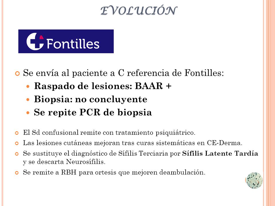 evolución Se envía al paciente a C referencia de Fontilles: