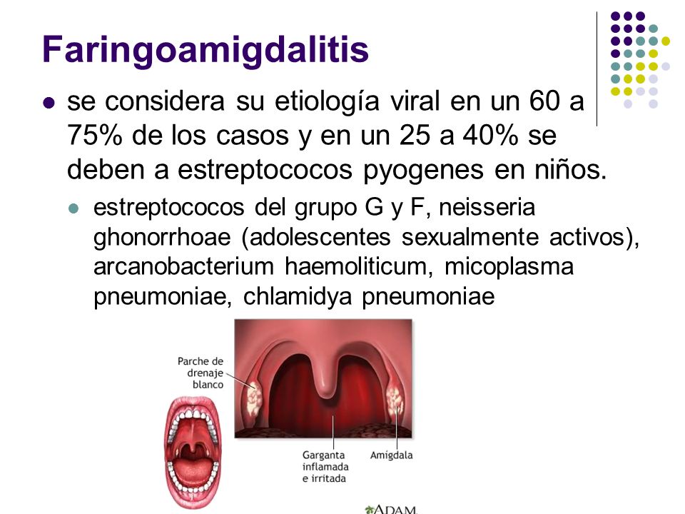 Faringoamigdalitis se considera su etiología viral en un 60 a 75% de los casos y en un 25 a 40% se deben a estreptococos pyogenes en niños.