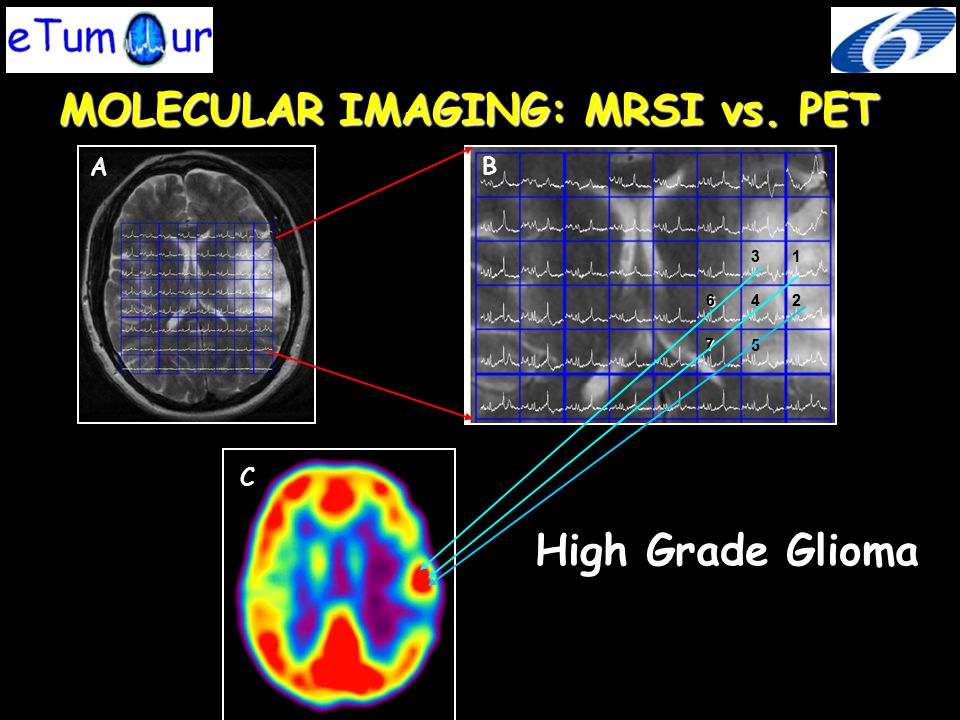 MOLECULAR IMAGING: MRSI vs. PET