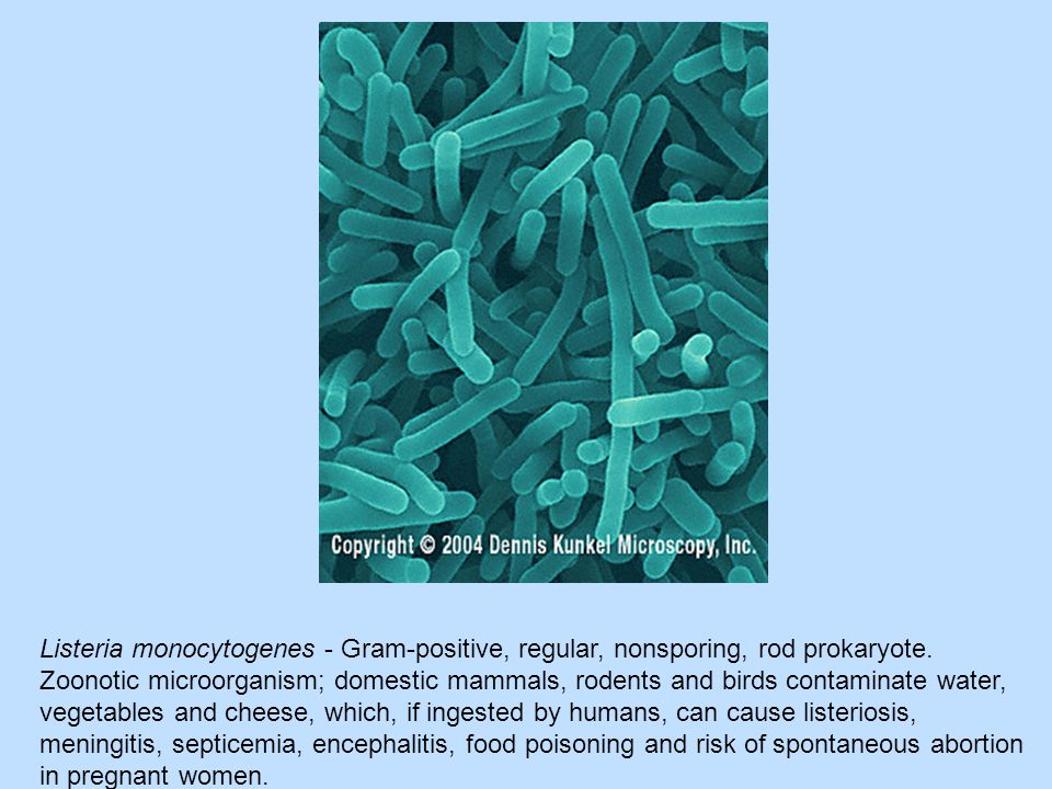Listeria monocytogenes - Gram-positive, regular, nonsporing, rod prokaryote.