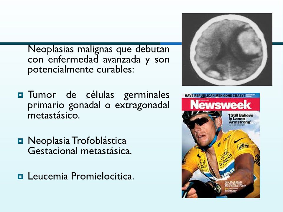 Neoplasias malignas que debutan con enfermedad avanzada y son potencialmente curables: