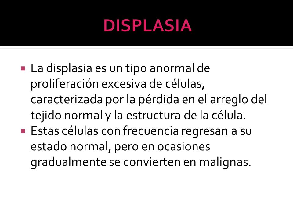 DISPLASIA