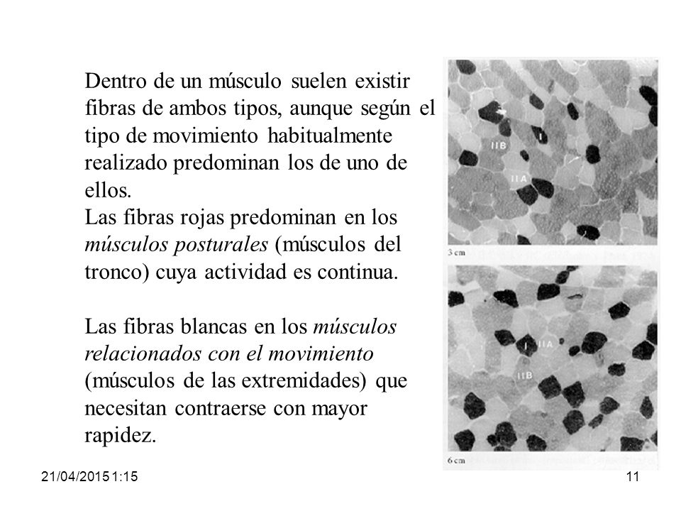Dentro de un músculo suelen existir fibras de ambos tipos, aunque según el tipo de movimiento habitualmente realizado predominan los de uno de ellos.