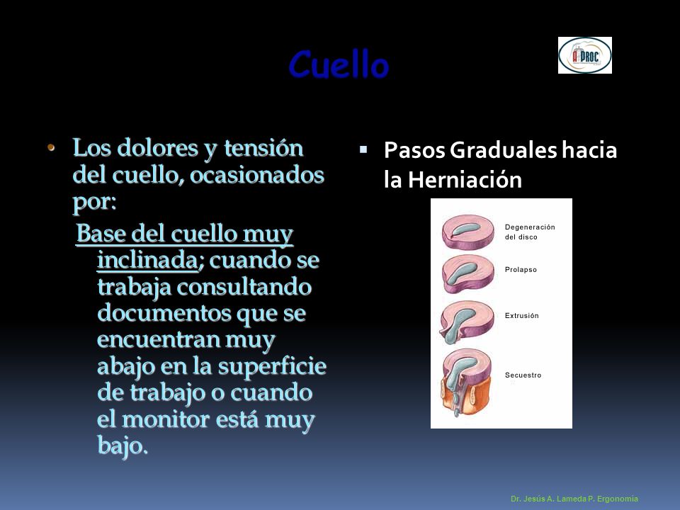 Cuello Los dolores y tensión del cuello, ocasionados por: