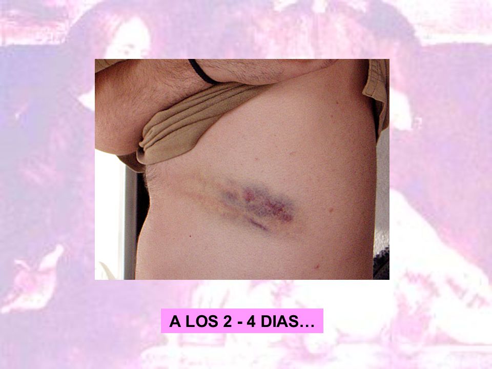 A LOS DIAS…