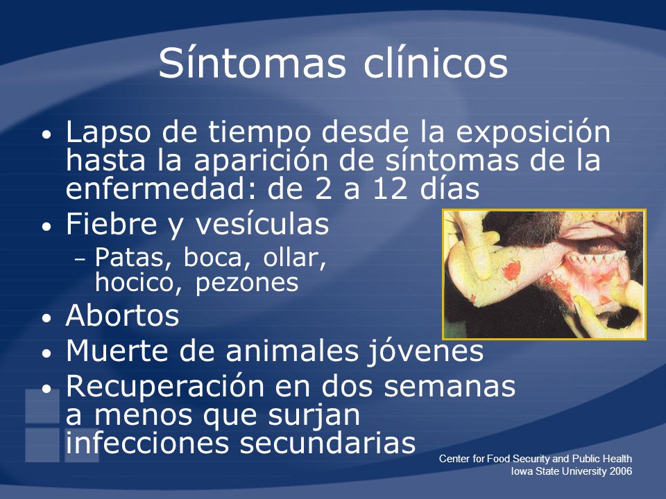 Síntomas clínicos Lapso de tiempo desde la exposición hasta la aparición de síntomas de la enfermedad: de 2 a 12 días.