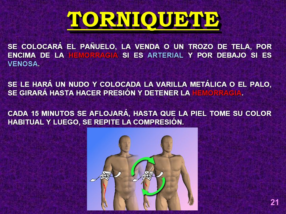 TORNIQUETE SE COLOCARÁ EL PAÑUELO, LA VENDA O UN TROZO DE TELA, POR ENCIMA DE LA HEMORRAGIA SI ES ARTERIAL Y POR DEBAJO SI ES VENOSA.