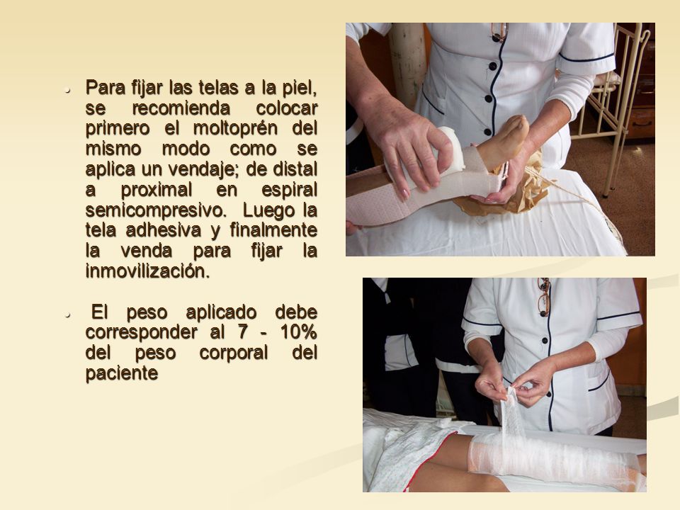 Para fijar las telas a la piel, se recomienda colocar primero el moltoprén del mismo modo como se aplica un vendaje; de distal a proximal en espiral semicompresivo. Luego la tela adhesiva y finalmente la venda para fijar la inmovilización.