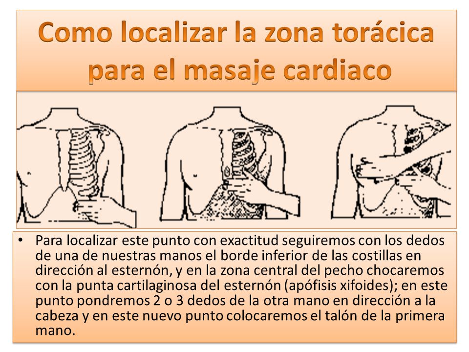 Como localizar la zona torácica para el masaje cardiaco