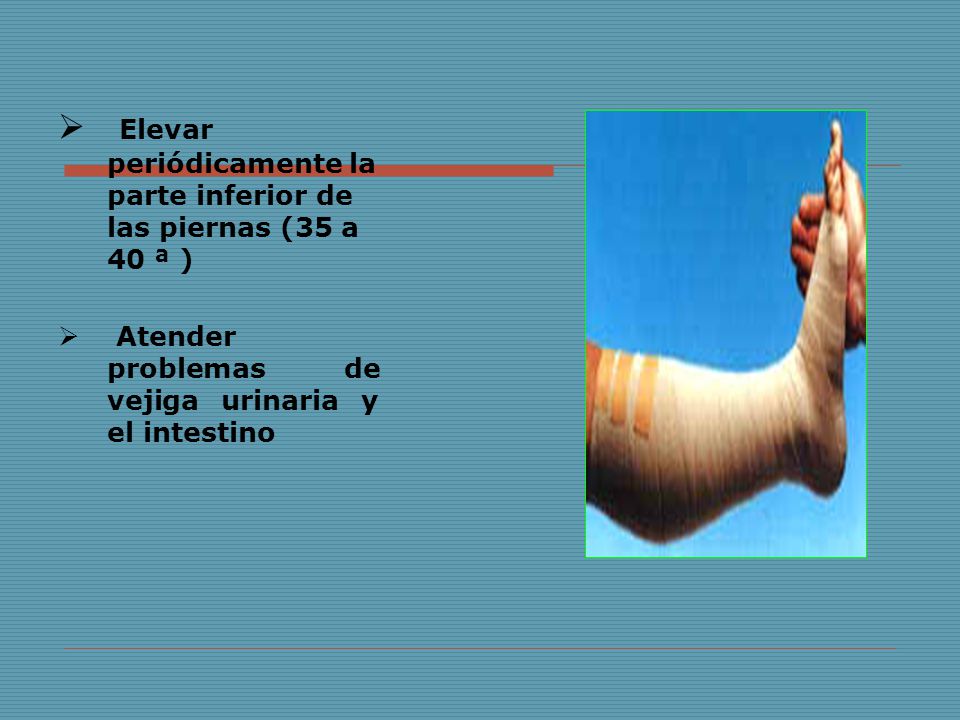 Elevar periódicamente la parte inferior de las piernas (35 a 40 ª )