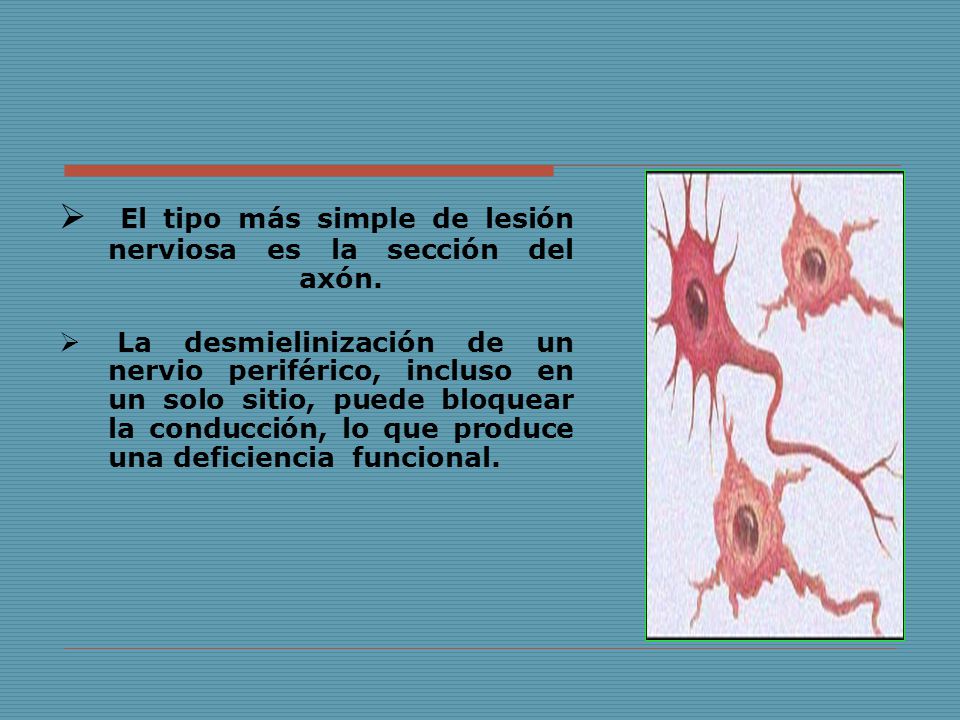 El tipo más simple de lesión nerviosa es la sección del axón.