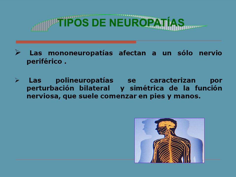 TIPOS DE NEUROPATÍAS Las mononeuropatías afectan a un sólo nervio periférico .
