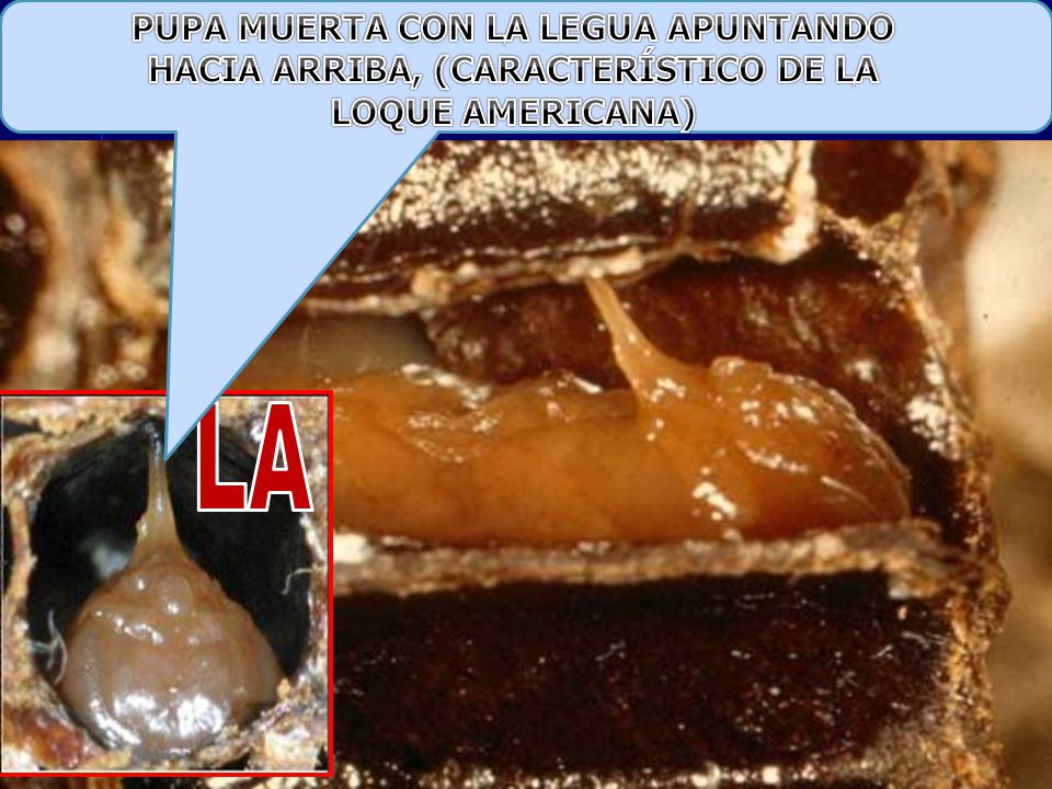 PUPA MUERTA CON LA LEGUA APUNTANDO HACIA ARRIBA, (CARACTERÍSTICO DE LA LOQUE AMERICANA)