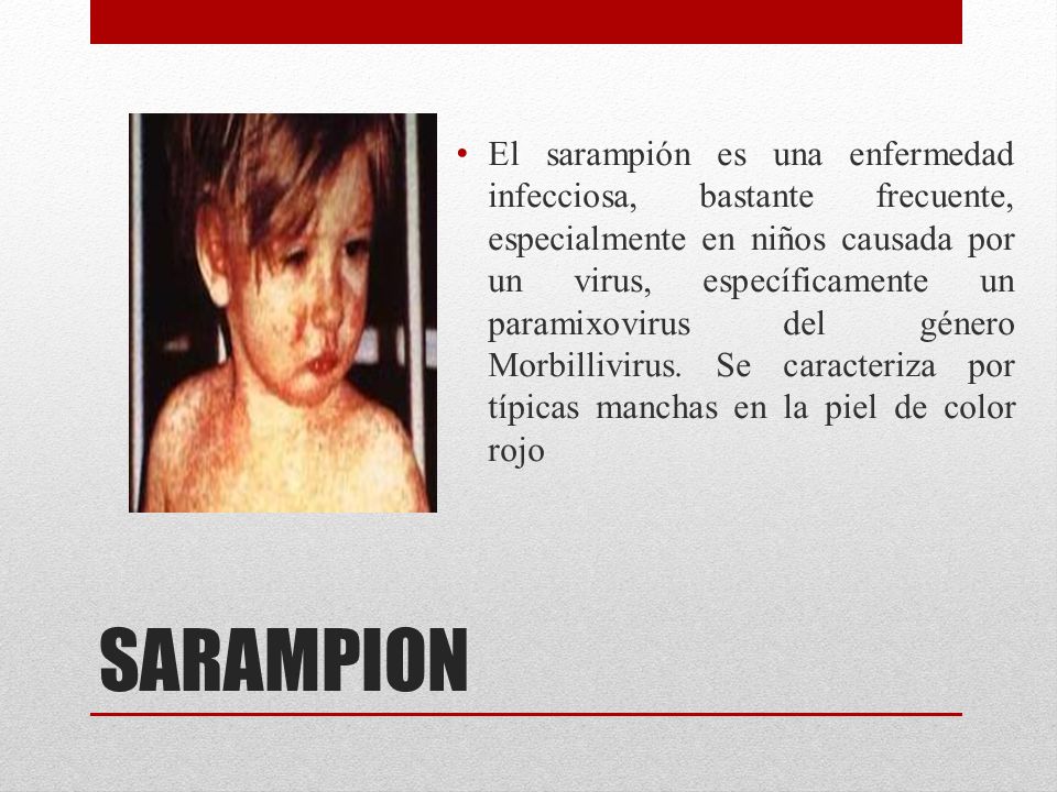 El sarampión es una enfermedad infecciosa, bastante frecuente, especialmente en niños causada por un virus, específicamente un paramixovirus del género Morbillivirus. Se caracteriza por típicas manchas en la piel de color rojo
