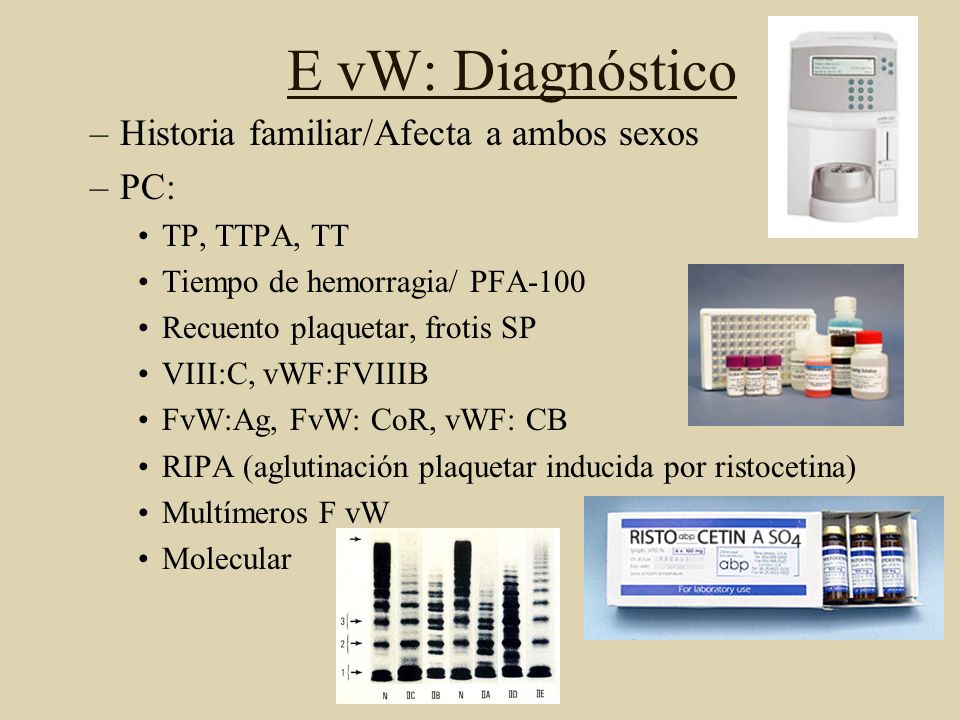 E vW: Diagnóstico Historia familiar/Afecta a ambos sexos PC: