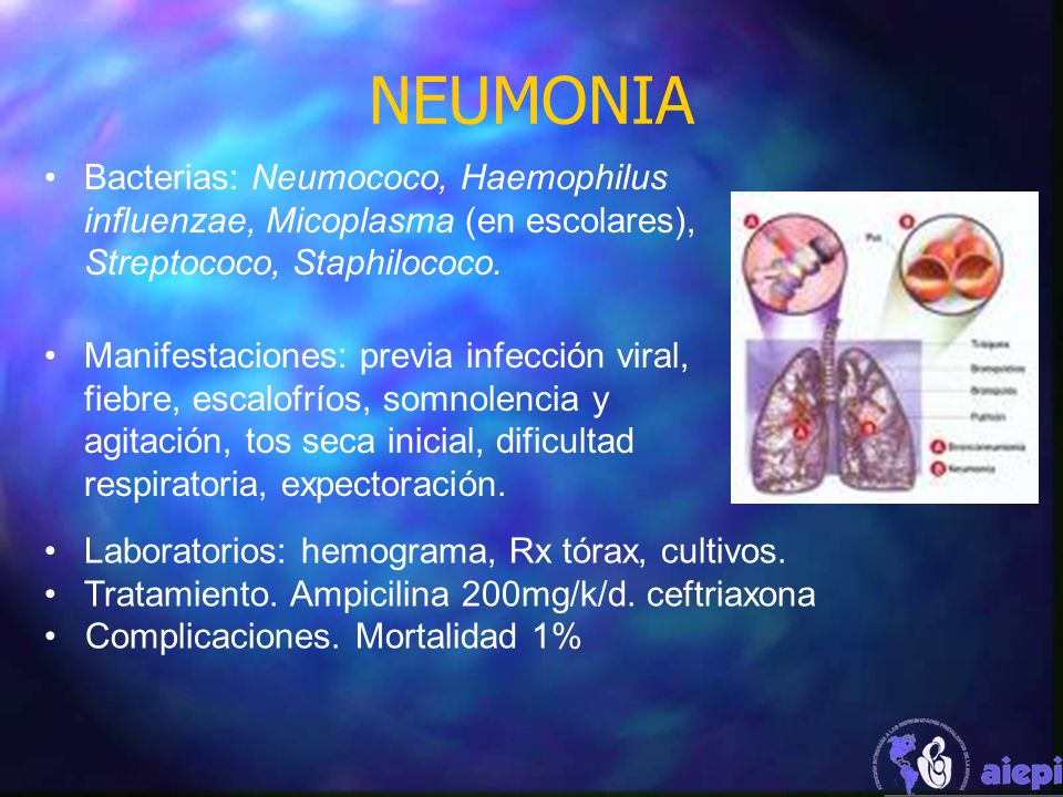 NEUMONIA Bacterias: Neumococo, Haemophilus influenzae, Micoplasma (en escolares), Streptococo, Staphilococo.