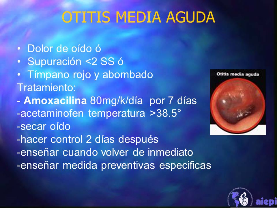 OTITIS MEDIA AGUDA Dolor de oído ó Supuración <2 SS ó