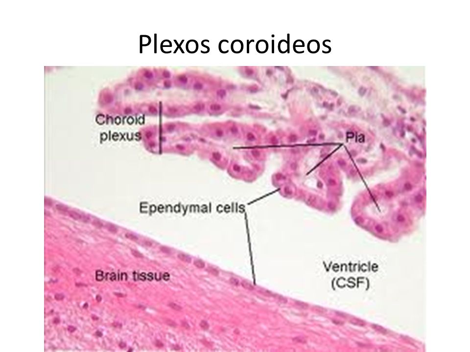 Plexos coroideos
