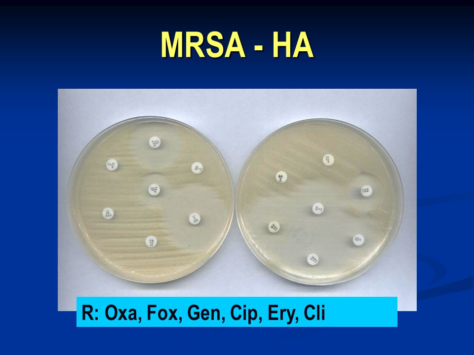 MRSA - HA R: Oxa, Fox, Gen, Cip, Ery, Cli