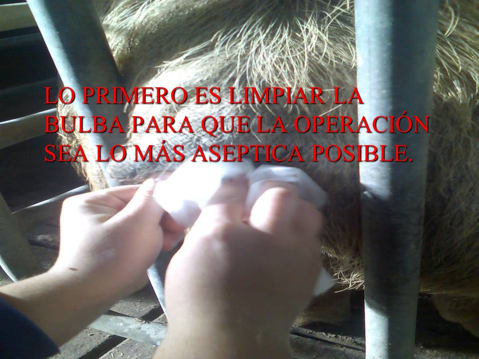 LO PRIMERO ES LIMPIAR LA BULBA PARA QUE LA OPERACIÓN SEA LO MÁS ASEPTICA POSIBLE.