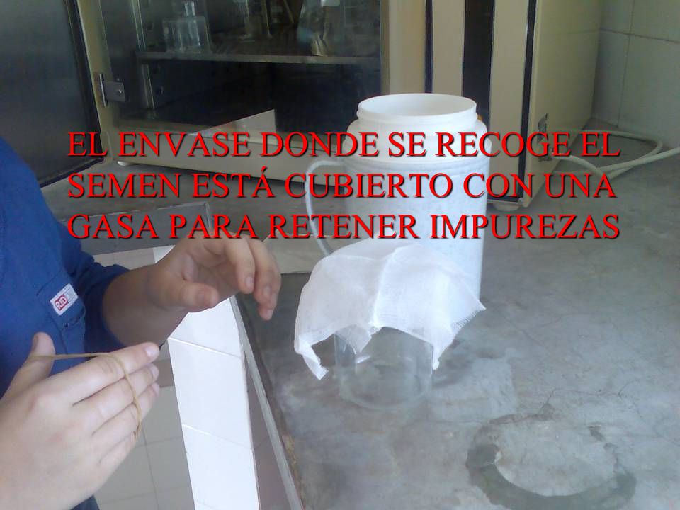 EL ENVASE DONDE SE RECOGE EL SEMEN ESTÁ CUBIERTO CON UNA GASA PARA RETENER IMPUREZAS