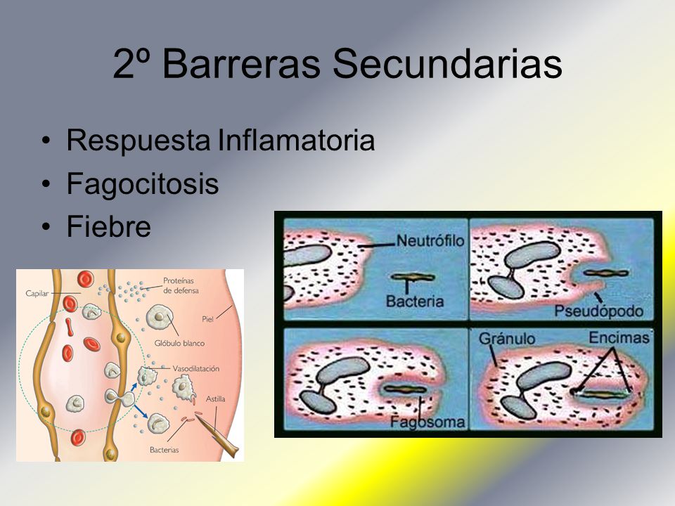 2º Barreras Secundarias