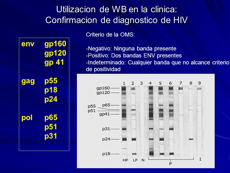 Utilizacion de WB en la clinica: Confirmacion de diagnostico de HIV