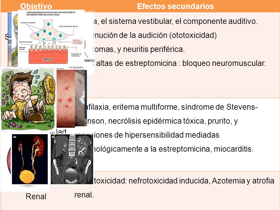 Objetivo Efectos secundarios. Sistema nervioso. Afecta, el sistema vestibular, el componente auditivo. Disminución de la audición (ototoxicidad)