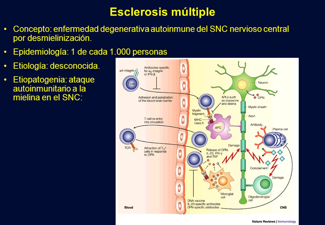 Esclerosis múltiple Concepto: enfermedad degenerativa autoinmune del SNC nervioso central por desmielinización.