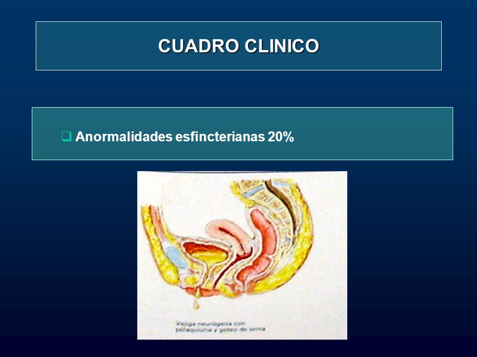 CUADRO CLINICO Anormalidades esfincterianas 20%