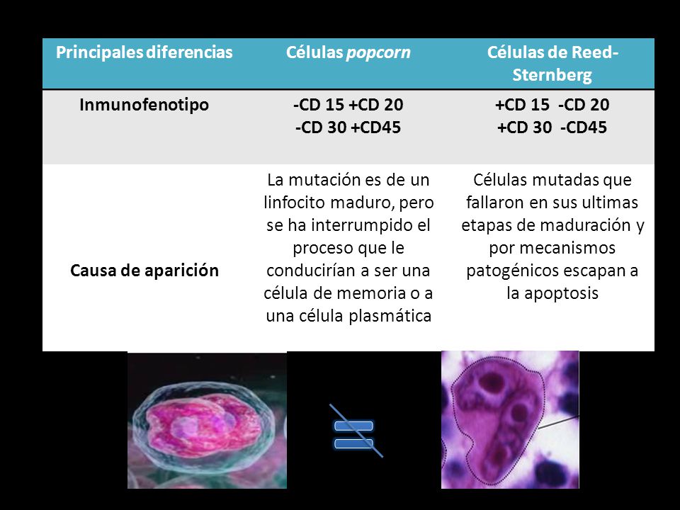 Principales diferencias Células de Reed-Sternberg