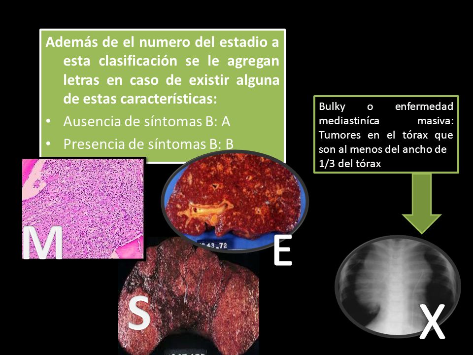 Además de el numero del estadio a esta clasificación se le agregan letras en caso de existir alguna de estas características: