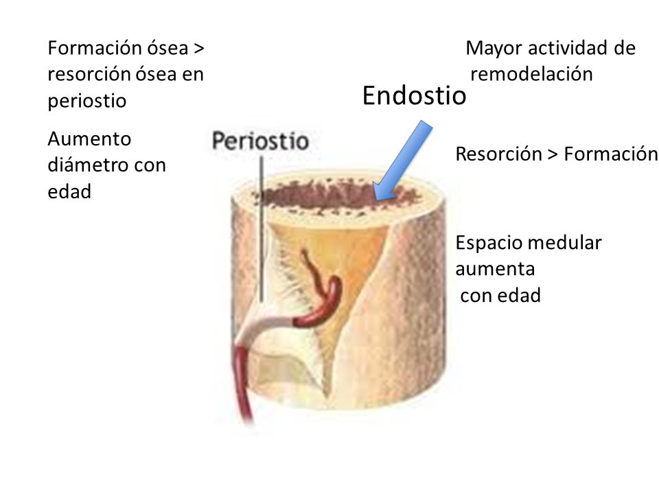 Endostio Formación ósea > resorción ósea en periostio
