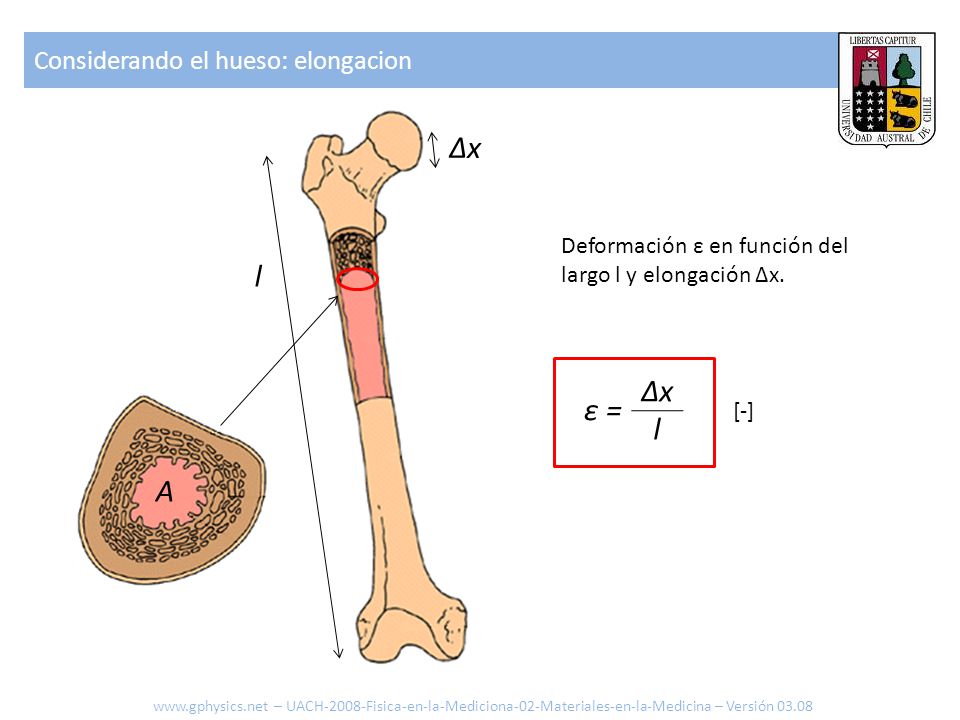 Δx l Δx l ε = A Considerando el hueso: elongacion