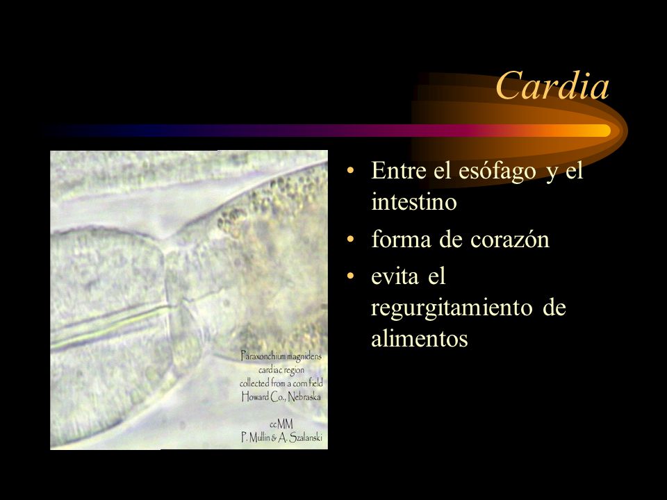 Cardia Entre el esófago y el intestino forma de corazón