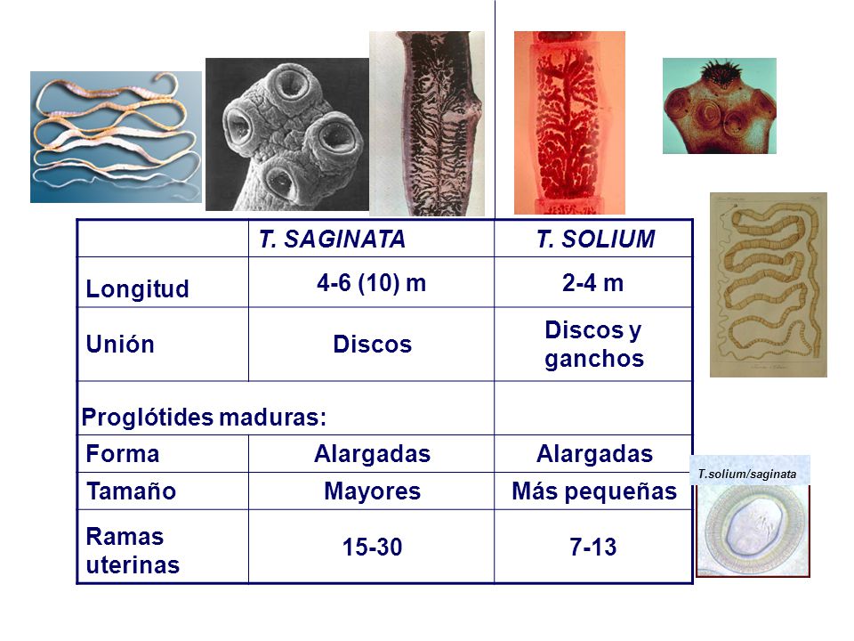 T. SAGINATA T. SOLIUM Longitud 4-6 (10) m 2-4 m Unión Discos